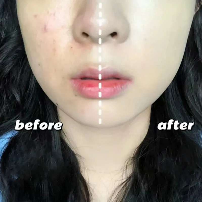 Yeknu Moisturizing Concealer Air Cushion CC Cream Natural Waterproof Brighten Cushion Foundation High Coverage Makeup Base Cosmetics